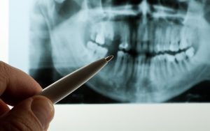 Oral Surgery Imaging