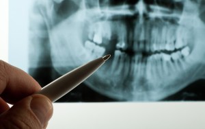 Oral Surgery Imaging