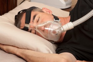Sleep Apnea Appliance