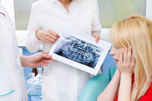 Bone Grafting for Dental Implants
