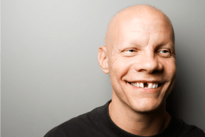 missing-teeth