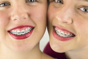 wisdom teeth removal braces