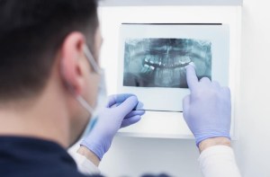 How to Choose an Oral Surgeon: 6 Factors to Consider