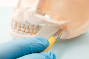 TMJ disorder headaches