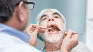12 Facts About Oral Cancer