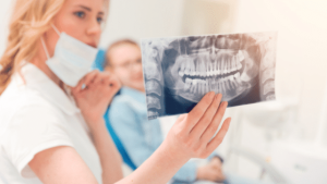 Signs That Tells You Have Impacted Wisdom Teeth
