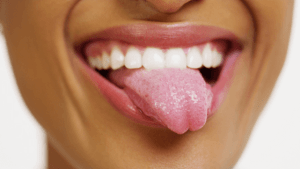 What Your Tongue Can Says About Your Overall Health