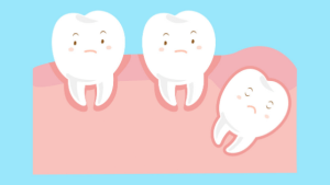 My Wisdom Teeth Aren’t Causing Me Any Problems, Can I Keep Them?