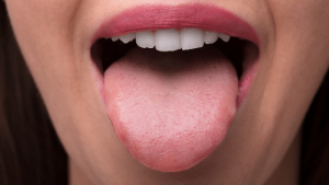 What Your Tongue Is Trying To Tell You