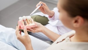 Are Dental Implants as Strong as Real Teeth