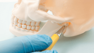 TMJ Syndrome Treatment Options