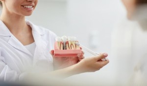 What Materials Make up Dental Implants?