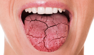 Most Common Dental Problems in Seniors
