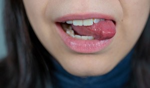 Is Accidentally Biting Your Tongue Dangerous?